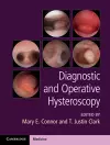 Diagnostic and Operative Hysteroscopy cover