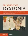 Treatment of Dystonia cover