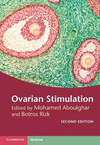 Ovarian Stimulation cover