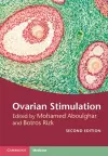 Ovarian Stimulation cover