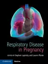 Respiratory Disease in Pregnancy cover