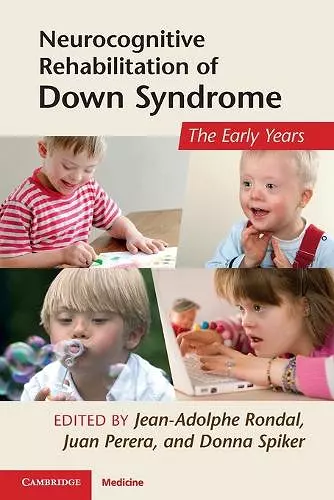 Neurocognitive Rehabilitation of Down Syndrome cover