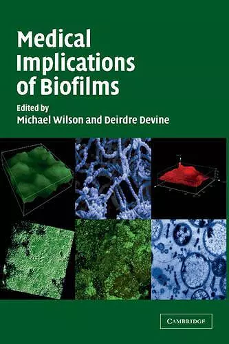 Medical Implications of Biofilms cover