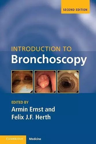 Introduction to Bronchoscopy cover