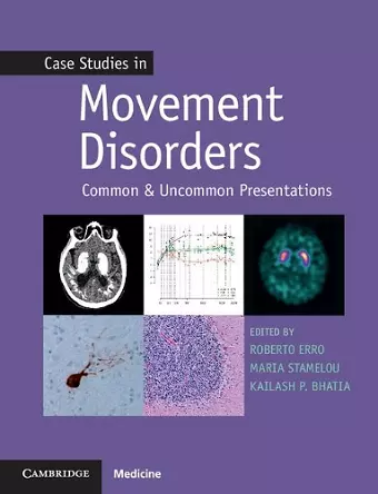 Case Studies in Movement Disorders cover