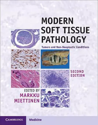 Modern Soft Tissue Pathology cover