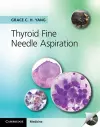 Thyroid Fine Needle Aspiration with CD Extra cover