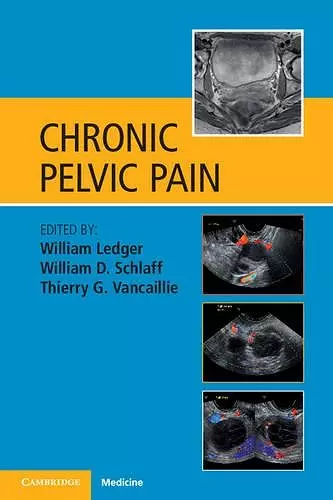 Chronic Pelvic Pain cover