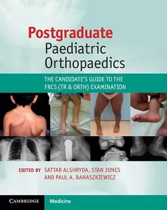 Postgraduate Paediatric Orthopaedics cover