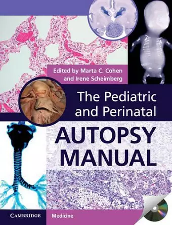 The Pediatric and Perinatal Autopsy Manual with DVD-ROM cover