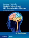 Common Pitfalls in Multiple Sclerosis and CNS Demyelinating Diseases cover