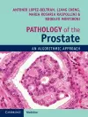 Pathology of the Prostate cover