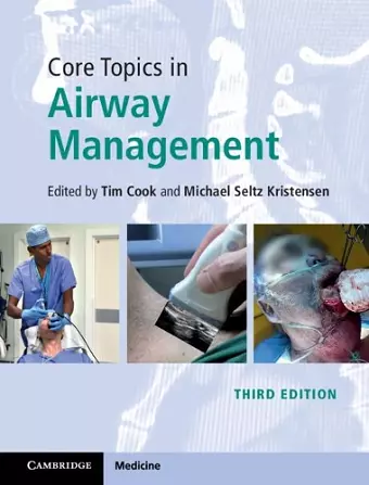 Core Topics in Airway Management cover