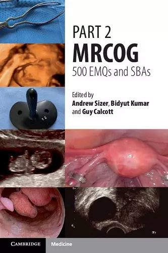 Part 2 MRCOG: 500 EMQs and SBAs cover