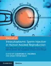 Manual of Intracytoplasmic Sperm Injection in Human Assisted Reproduction cover