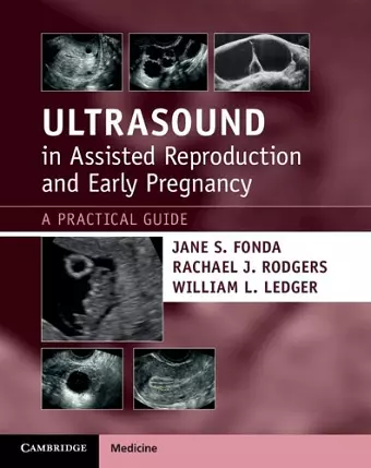 Ultrasound in Assisted Reproduction and Early Pregnancy cover