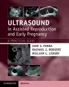 Ultrasound in Assisted Reproduction and Early Pregnancy cover