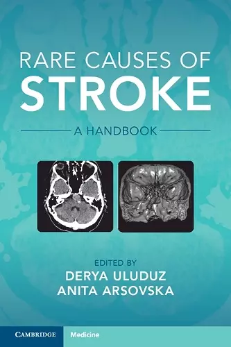 Rare Causes of Stroke cover