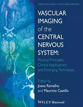 Vascular Imaging of the Central Nervous System cover