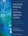 Vascular Imaging of the Central Nervous System cover