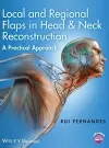 Local and Regional Flaps in Head and Neck Reconstruction cover