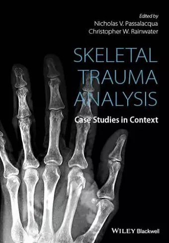 Skeletal Trauma Analysis cover