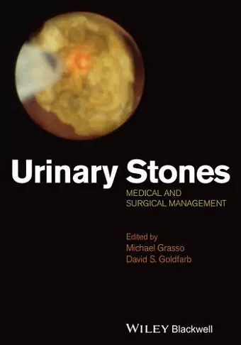 Urinary Stones cover