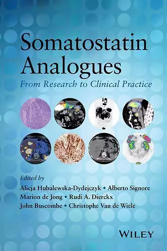 Somatostatin Analogues cover