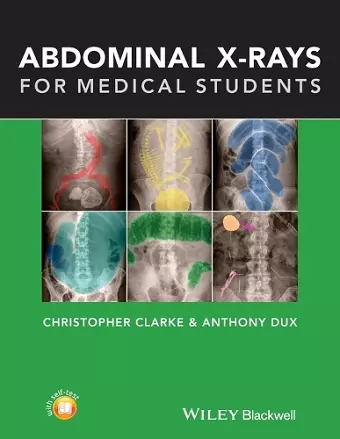 Abdominal X-rays for Medical Students cover