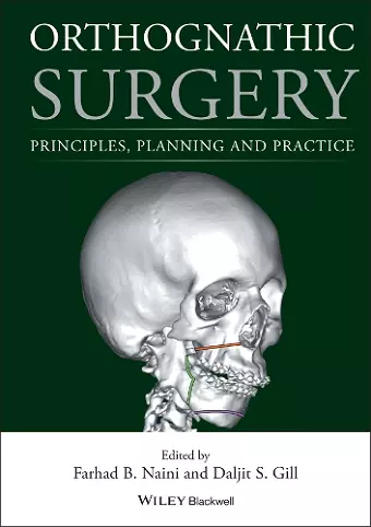 Orthognathic Surgery cover