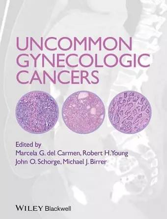 Uncommon Gynecologic Cancers cover