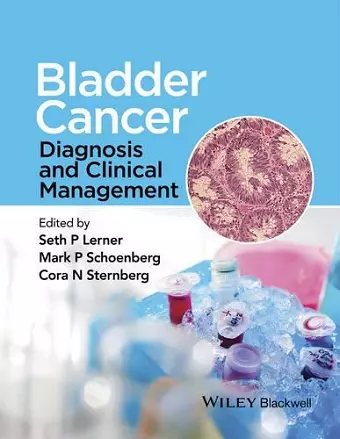 Bladder Cancer cover