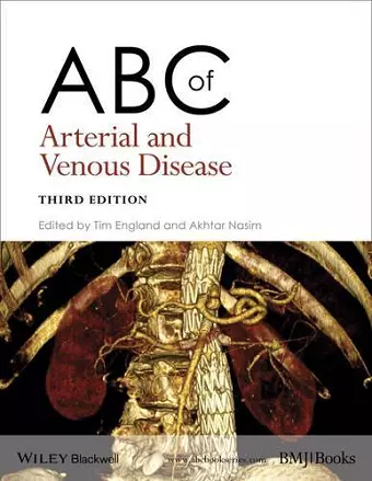 ABC of Arterial and Venous Disease cover