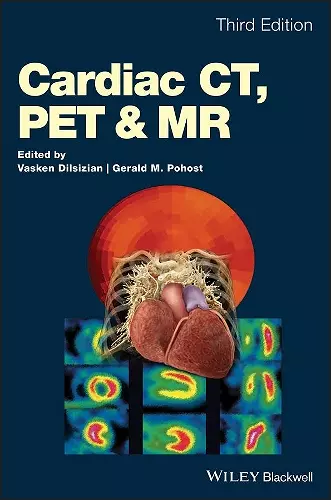 Cardiac CT, PET and MR cover