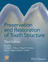 Preservation and Restoration of Tooth Structure cover