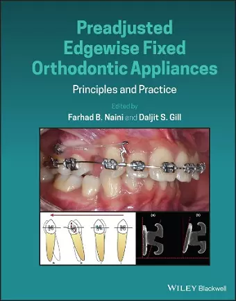 Preadjusted Edgewise Fixed Orthodontic Appliances cover