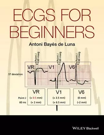 ECGs for Beginners cover