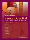 Female Genital Plastic and Cosmetic Surgery cover