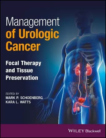 Management of Urologic Cancer cover