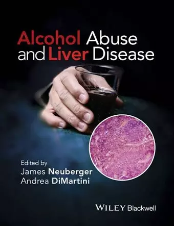 Alcohol Abuse and Liver Disease cover