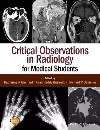 Critical Observations in Radiology for Medical Students cover