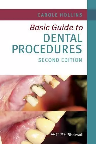Basic Guide to Dental Procedures cover