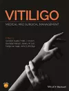 Vitiligo cover