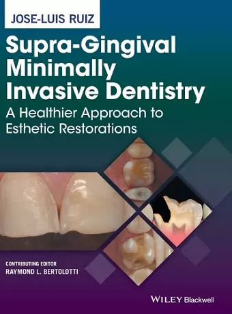 Supra-Gingival Minimally Invasive Dentistry cover