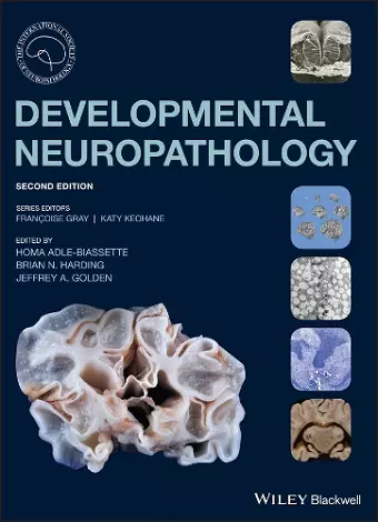 Developmental Neuropathology cover