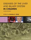 Diseases of the Liver and Biliary System in Children cover