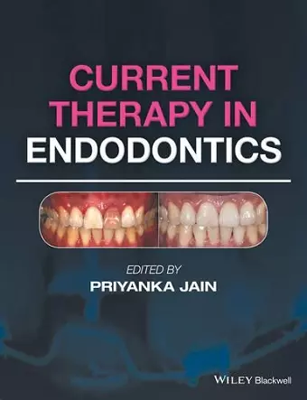 Current Therapy in Endodontics cover