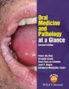 Oral Medicine and Pathology at a Glance cover