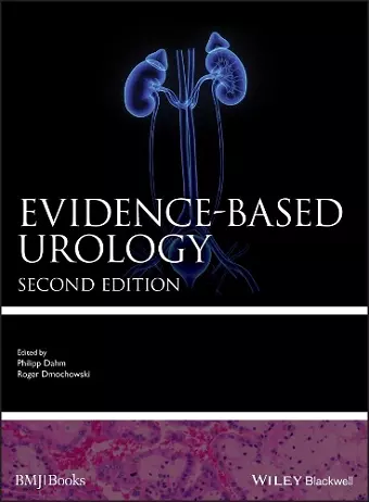 Evidence-based Urology cover