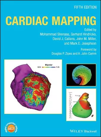 Cardiac Mapping cover